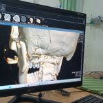 Seorang Warga Kritis di ICU…