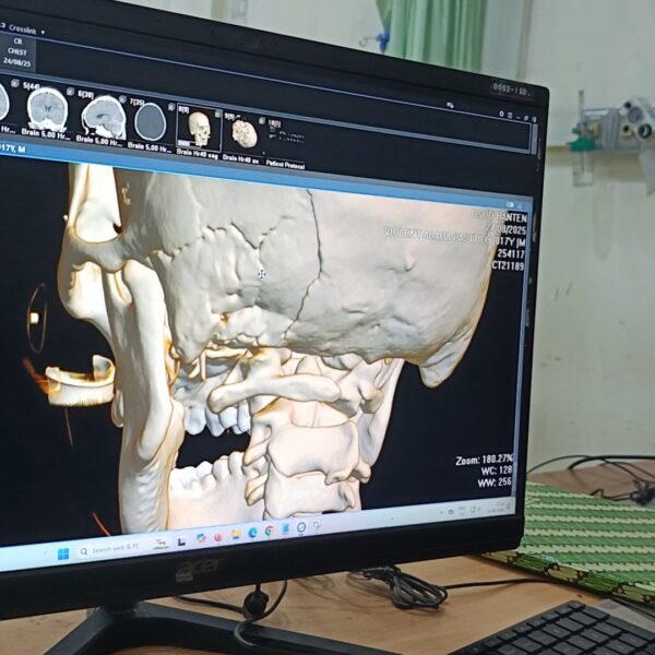 Seorang Warga Kritis di ICU Usai Diduga Dianiaya…