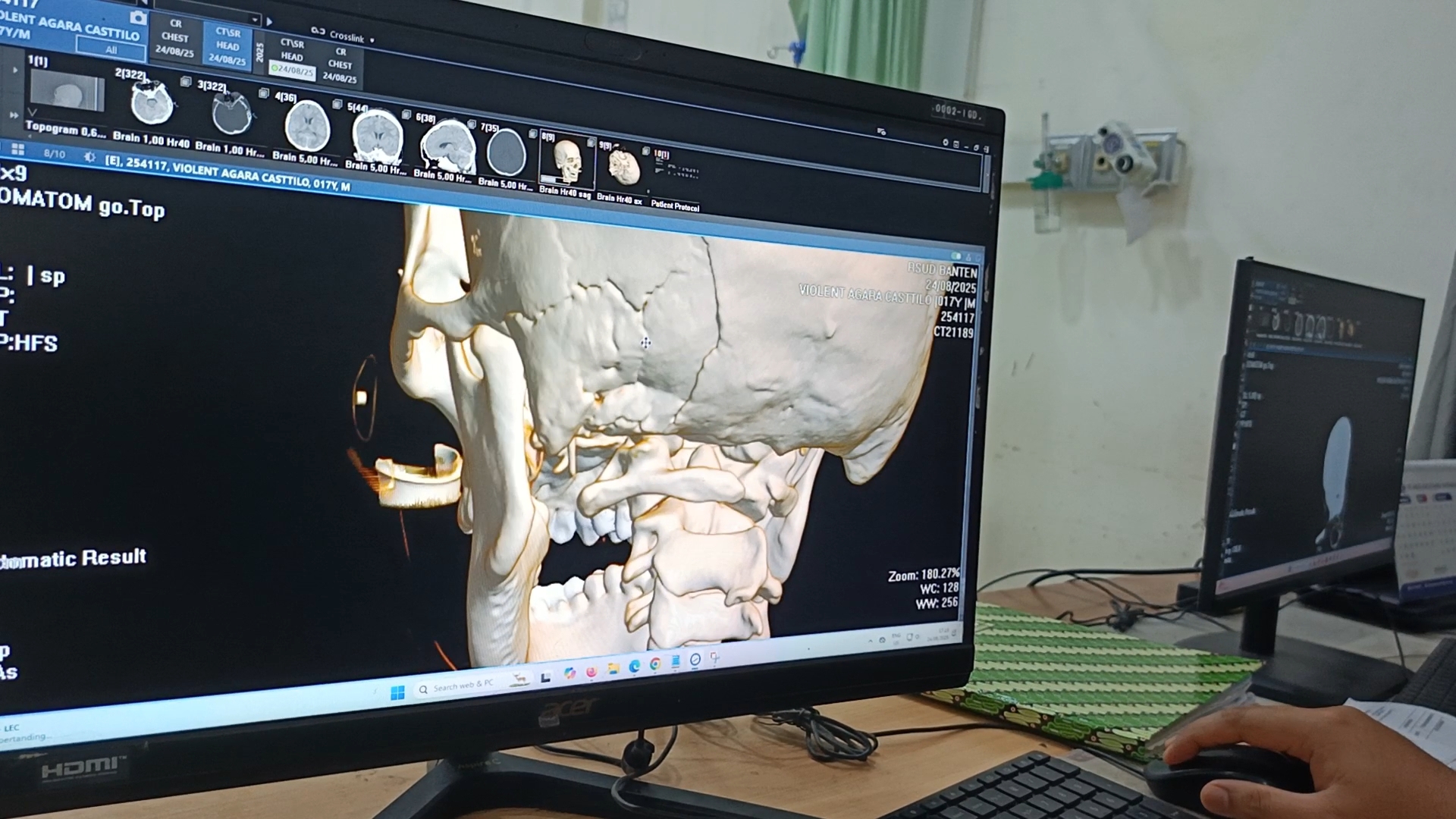 Seorang Warga Kritis di ICU Usai Diduga Dianiaya…